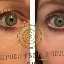 Resultado facial ojos antes y después