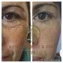 Tratamientos faciales Nutrición Body & Soul Spa